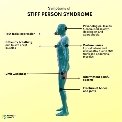 what is stiff person syndrome